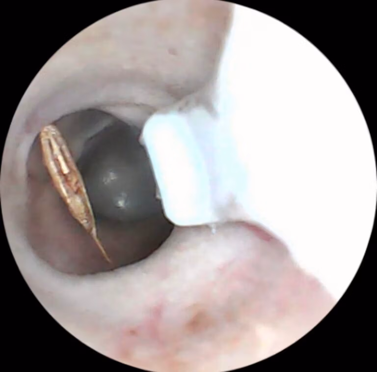 grass seed in fox ear